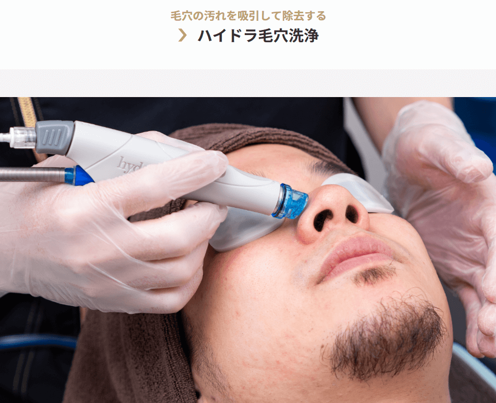 ゴリラクリニック　ハイドラ毛穴洗浄